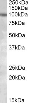 PKD2 Antibody in Western Blot (WB)