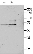 SRF Antibody in Western Blot (WB)