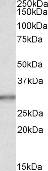 Carbonic Anhydrase I Antibody in Western Blot (WB)