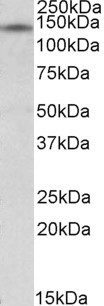 RIP140 Antibody in Western Blot (WB)