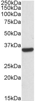 Calponin 2 Antibody in Western Blot (WB)