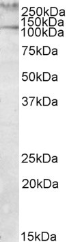 Talin 1 Antibody in Western Blot (WB)