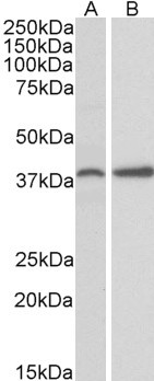 PRKCDBP Antibody in Western Blot (WB)