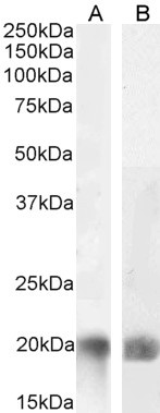 LIGHT Antibody in Western Blot (WB)