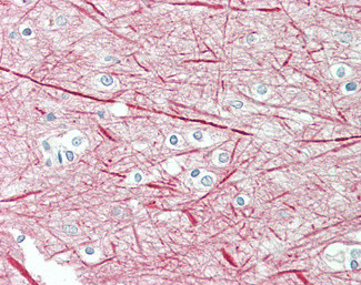 NEFM Antibody in Immunohistochemistry (Paraffin) (IHC (P))