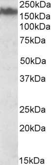 NEFM Antibody in Western Blot (WB)