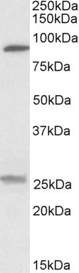 SLC4A11 Antibody in Western Blot (WB)