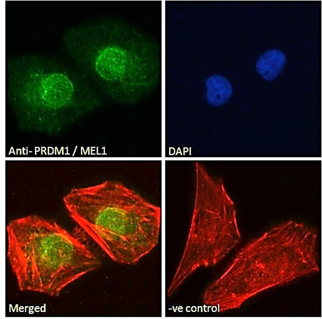 Blimp-1 Antibody in Immunocytochemistry (ICC/IF)