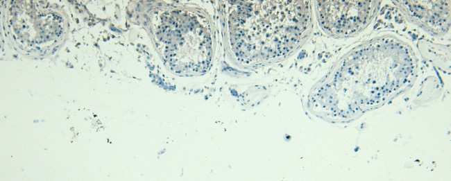 Blimp-1 Antibody in Immunohistochemistry (Paraffin) (IHC (P))