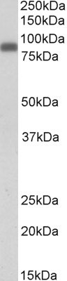 Zyxin Antibody in Western Blot (WB)