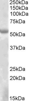 EYA1 Antibody in Western Blot (WB)