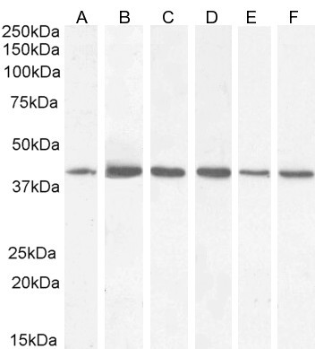 ACAT1 Antibody in Western Blot (WB)