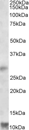 RNF7 Antibody in Western Blot (WB)