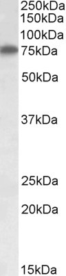 RARS Antibody in Western Blot (WB)