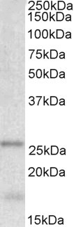 TPPP Antibody in Western Blot (WB)