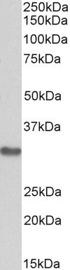 MAPRE3 Antibody in Western Blot (WB)