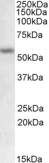 MMP12 Antibody in Western Blot (WB)