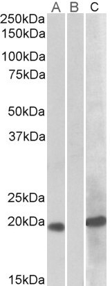 HOXA1 Antibody in Western Blot (WB)