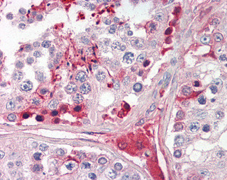 CRISP2 Antibody in Immunohistochemistry (Paraffin) (IHC (P))