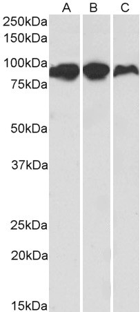 Aconitase 2 Antibody in Western Blot (WB)