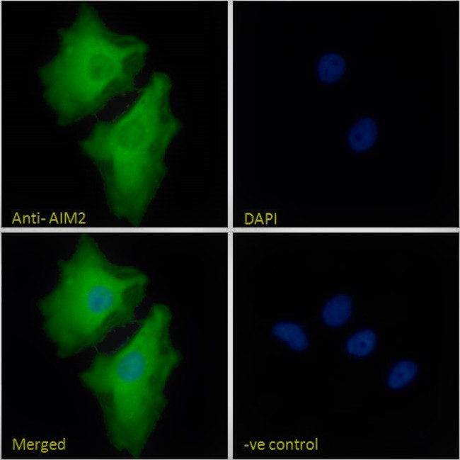 AIM2 Antibody in Immunocytochemistry (ICC/IF)