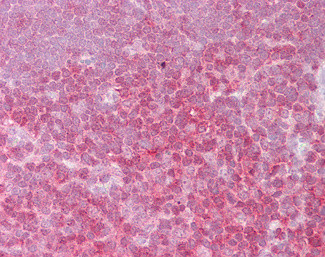 c-Rel Antibody in Immunohistochemistry (Paraffin) (IHC (P))