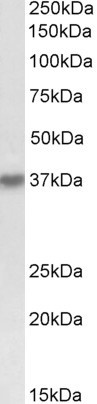 HSH2D Antibody in Western Blot (WB)