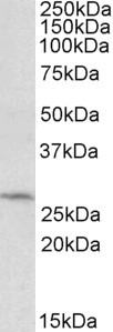 DCUN1D1 Antibody in Western Blot (WB)