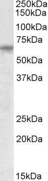 TTC8 Antibody in Western Blot (WB)