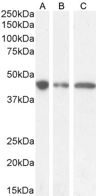 GNAS Antibody in Western Blot (WB)