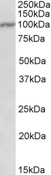 IL12RB1 Antibody in Western Blot (WB)