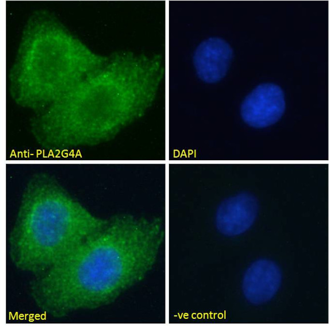 PLA2G4A Antibody in Immunocytochemistry (ICC/IF)