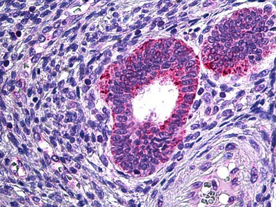 PLA2G4A Antibody in Immunohistochemistry (Paraffin) (IHC (P))