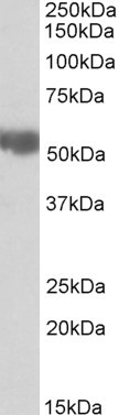 ALDH3A2 Antibody in Western Blot (WB)