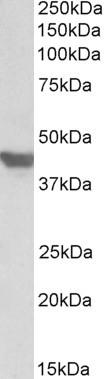 GLUT4 Antibody in Western Blot (WB)