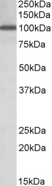 NUP107 Antibody in Western Blot (WB)