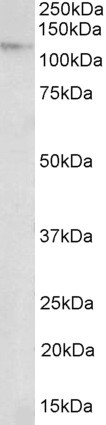 NUP107 Antibody in Western Blot (WB)