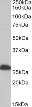 ETFB Antibody in Western Blot (WB)