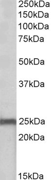 NDUFS8 Antibody in Western Blot (WB)