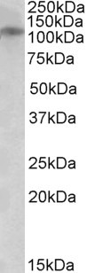 NMDAR3B Antibody in Western Blot (WB)