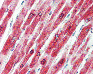 Phospholamban Antibody in Immunohistochemistry (Paraffin) (IHC (P))