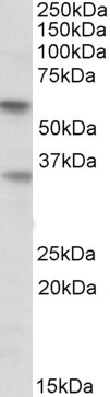 SIGLEC6 Antibody in Western Blot (WB)