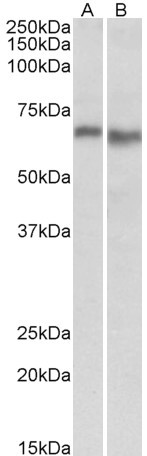 AMPK alpha-2 Antibody in Western Blot (WB)