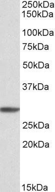 PSMA4 Antibody in Western Blot (WB)