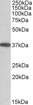 MOGAT2 Antibody in Western Blot (WB)