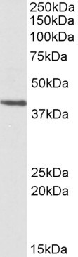 PSMB7 Antibody in Western Blot (WB)