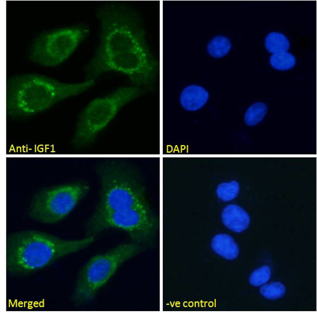 IGF1 Antibody in Immunocytochemistry (ICC/IF)