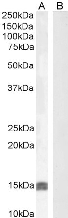 IGF1 Antibody in Western Blot (WB)