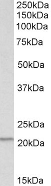 PSMB9 Antibody in Western Blot (WB)