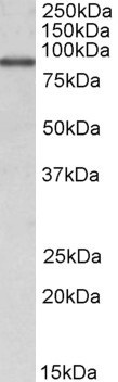 ALDH18A1 Antibody in Western Blot (WB)